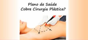 Plano de saúde cobre cirurgia plástica?